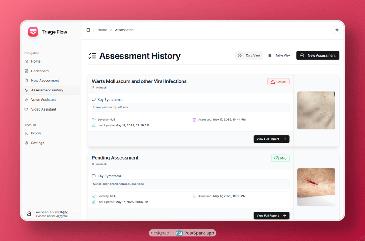 Second agent interface
